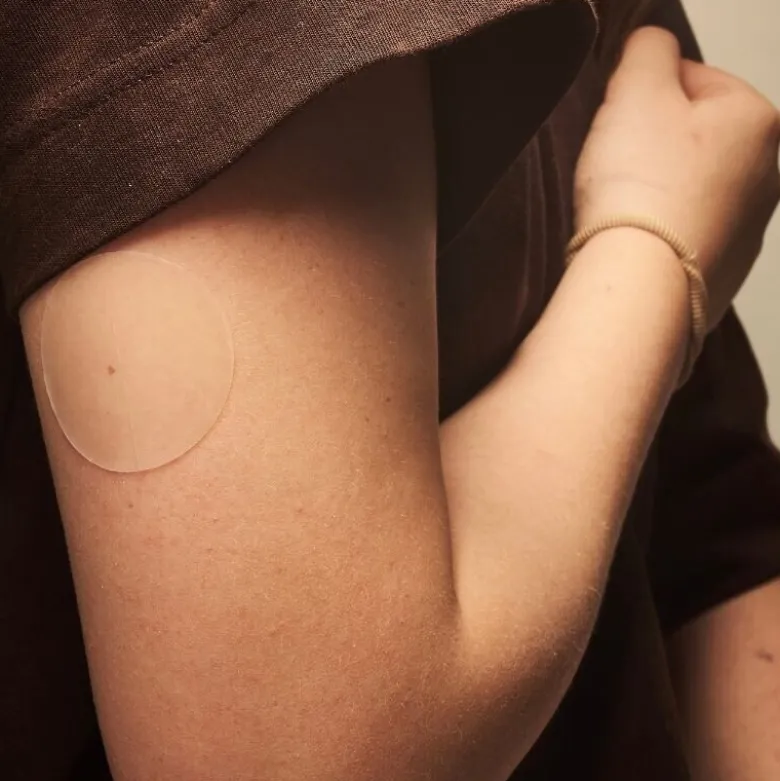 SensiPatch - til behandling af eksem efter diabetesudstyr